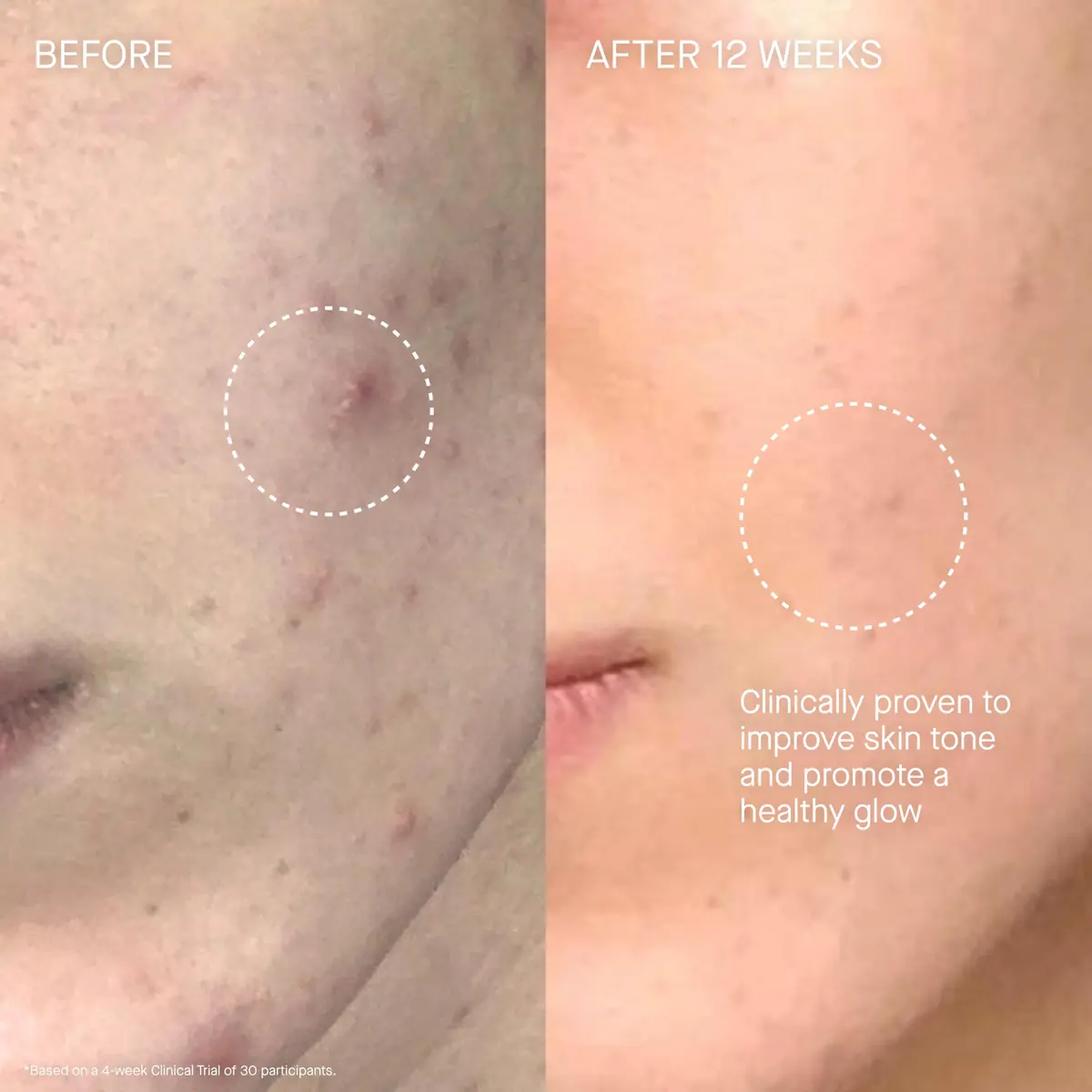 Augustinus Bader The Cream – Luxury Face Moisturizer 50ml | Hydrating & Nourishing for Wrinkle Reduction - view 5