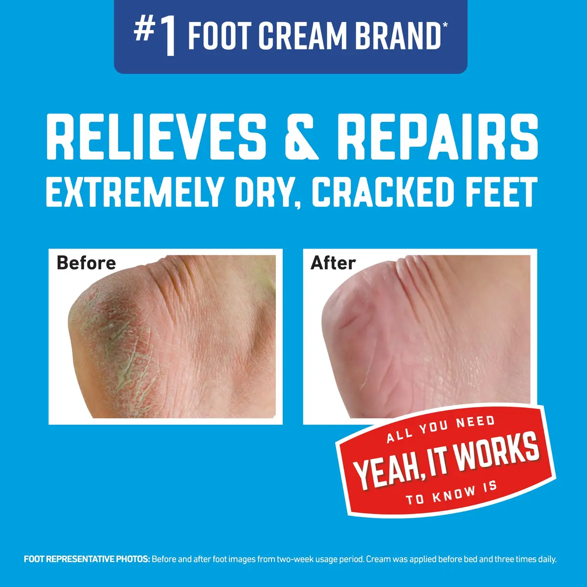 O'Keeffe's Healthy Feet Cream 7 oz (198 g) | Intensive Relief for Cracked Feet - view 2