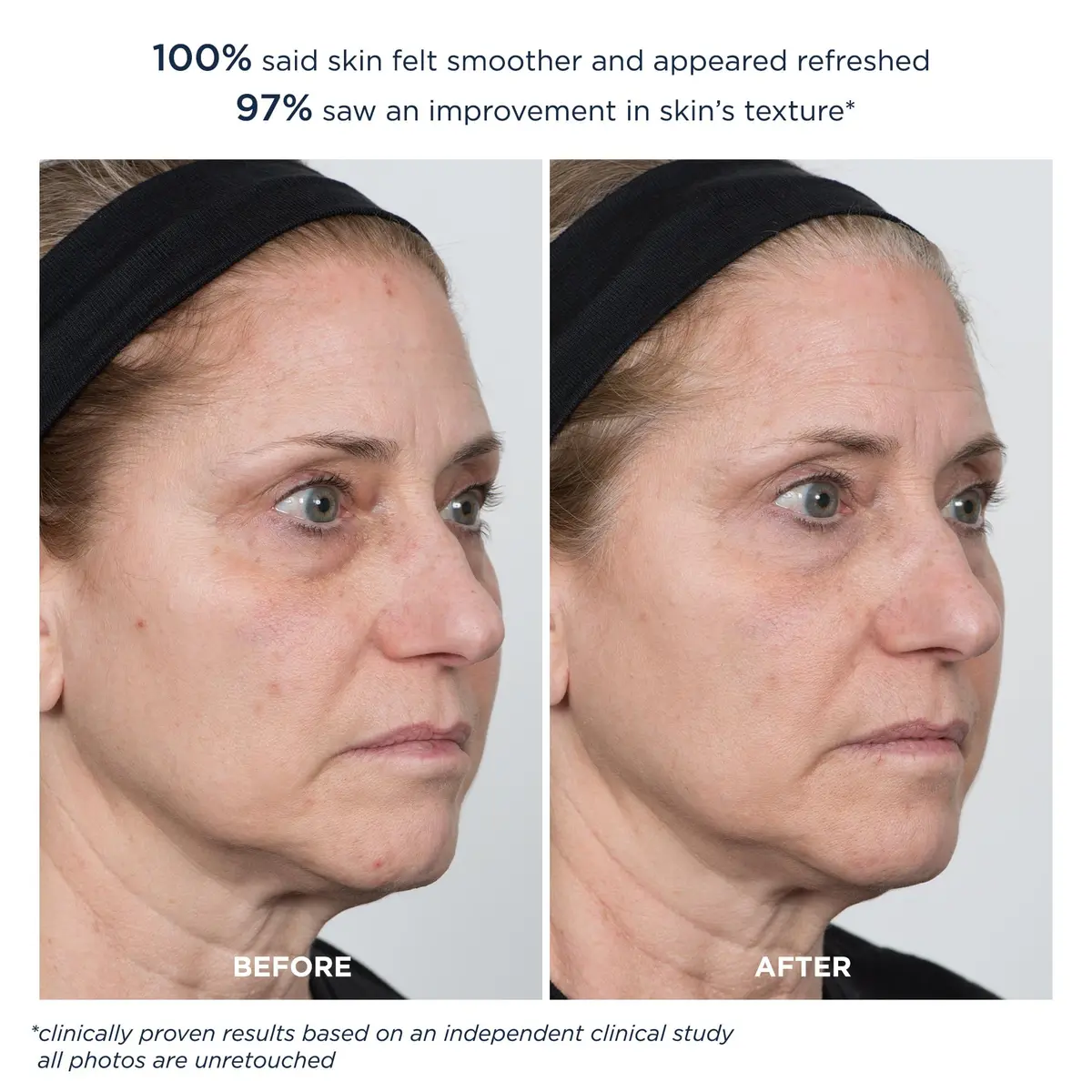 m-61 PowerGlow Peel Extra Strength 20% | Overnight Skin Resurfacing Treatment - view 6