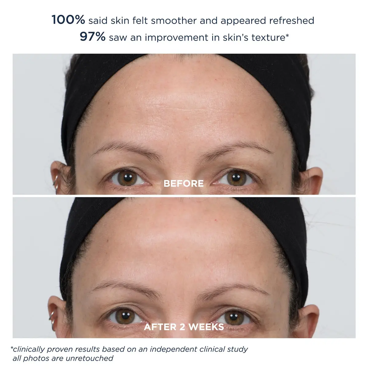 m-61 PowerGlow Peel Extra Strength 20% | Overnight Skin Resurfacing Treatment - view 7