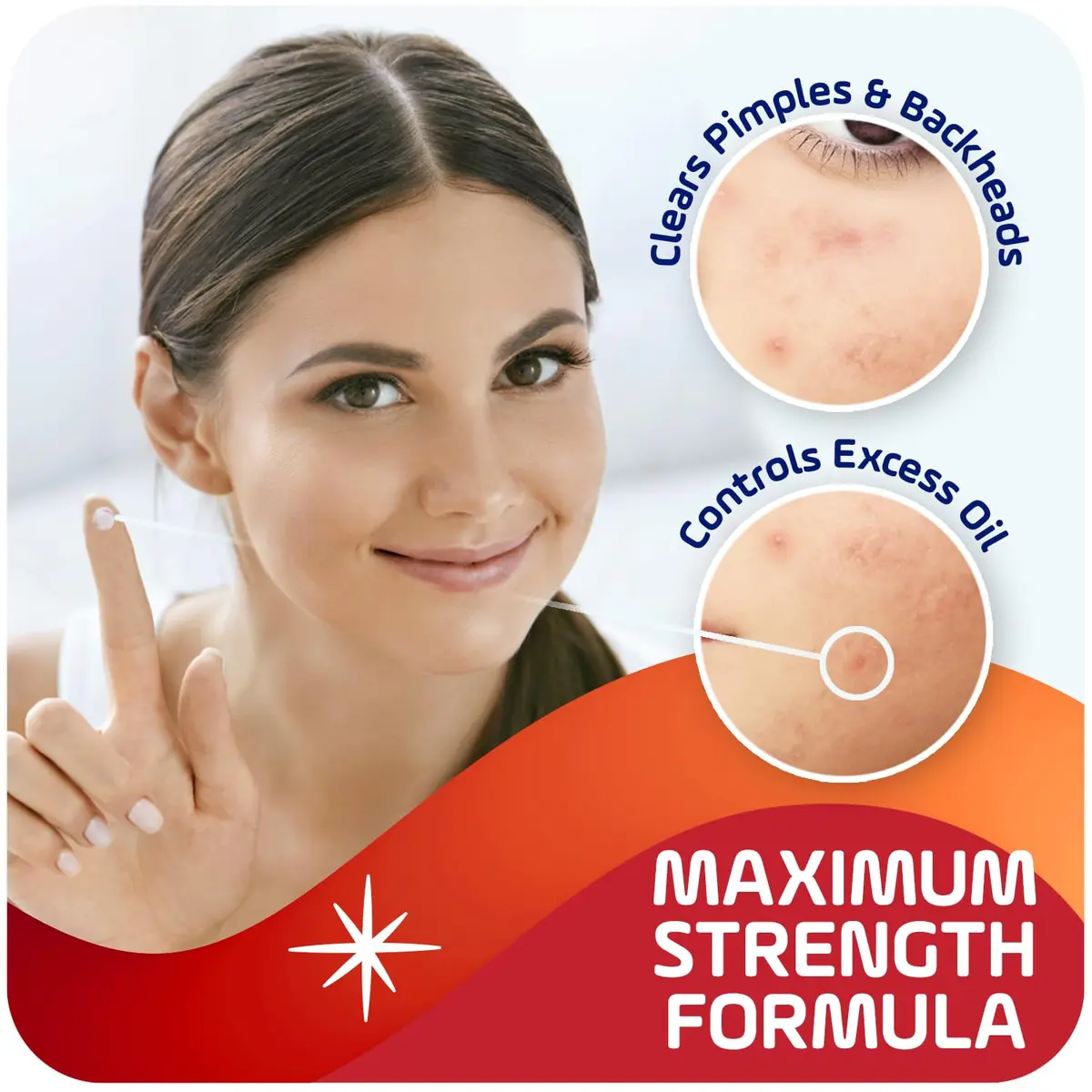Asepxia 2% Salicylic Acid Acne Spot Treatment Cream | Targets Blemishes & Redness, 1 Oz, 3-Pack - view 3
