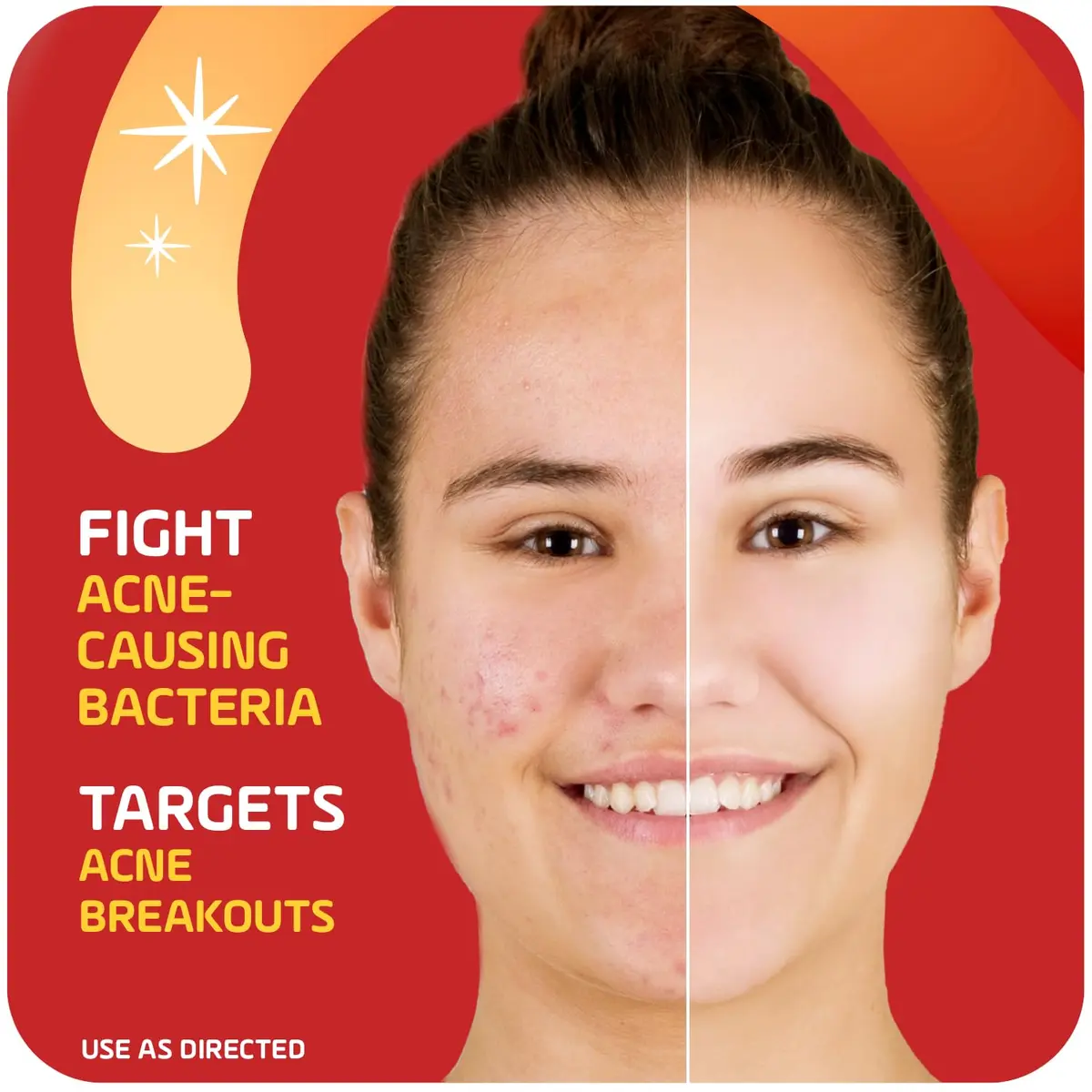Asepxia 2% Salicylic Acid Acne Spot Treatment Cream | Targets Blemishes & Redness, 1 Oz, 3-Pack - view 4