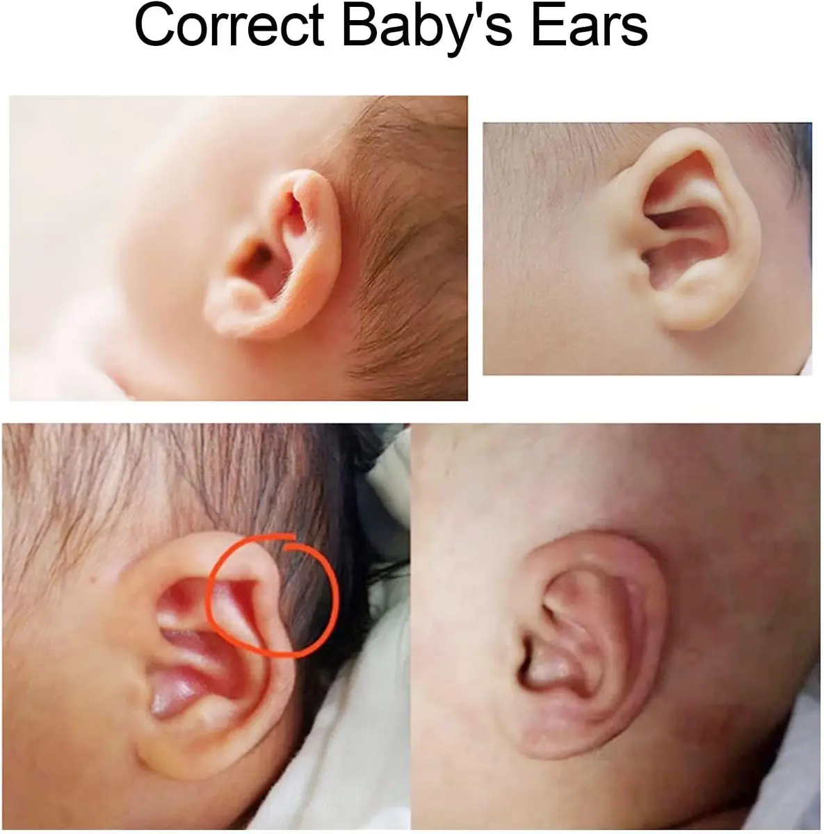Brrnoo Auricle Correction Patch 50cm x 4cm (1.97in x 1.6in) | Corrects Protruding Ears for Infants - view 7