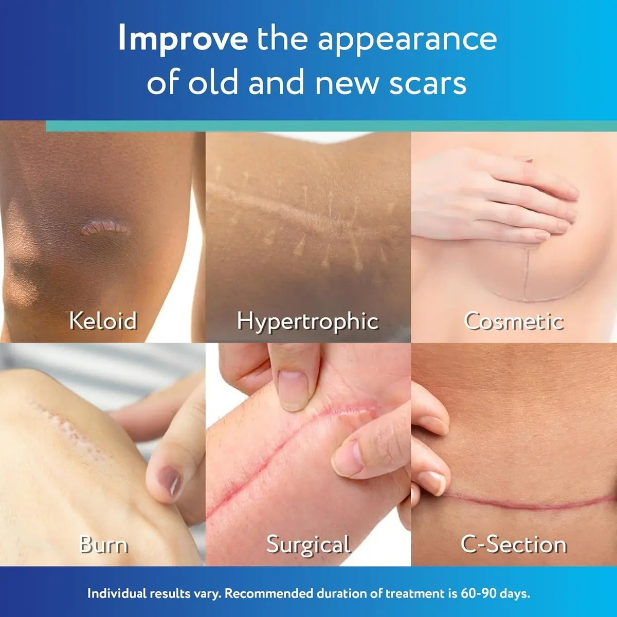 ScarAway Advanced Clear Silicone Scar Sheets, 6 Sheets | Visibly Improve Old & New Scars - view 2