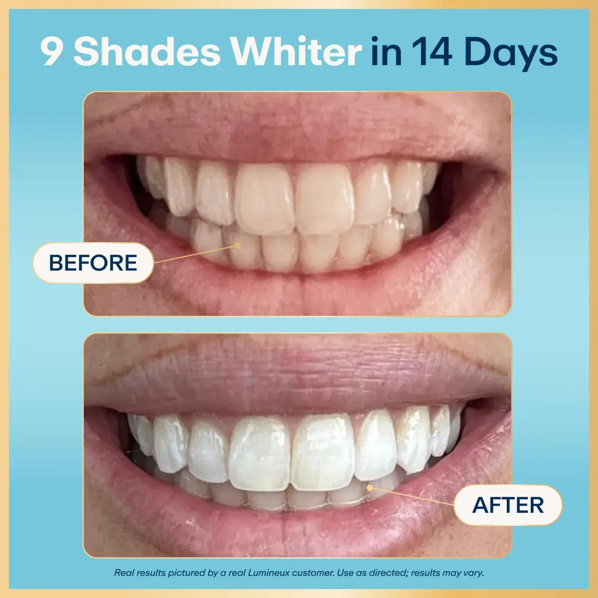 Lumineux Teeth Whitening Strips 18 Count (1 Month Supply) | Dentist-Formulated, Peroxide-Free, Enamel-Safe - view 2
