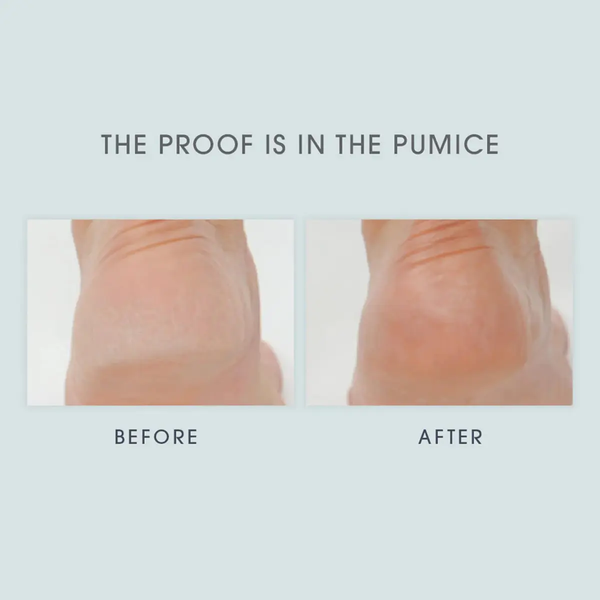 LATHER Vegan Skin Exfoliant 8 oz | Natural Foot & Body Scrub for Cracked Heels & Calluses - view 5