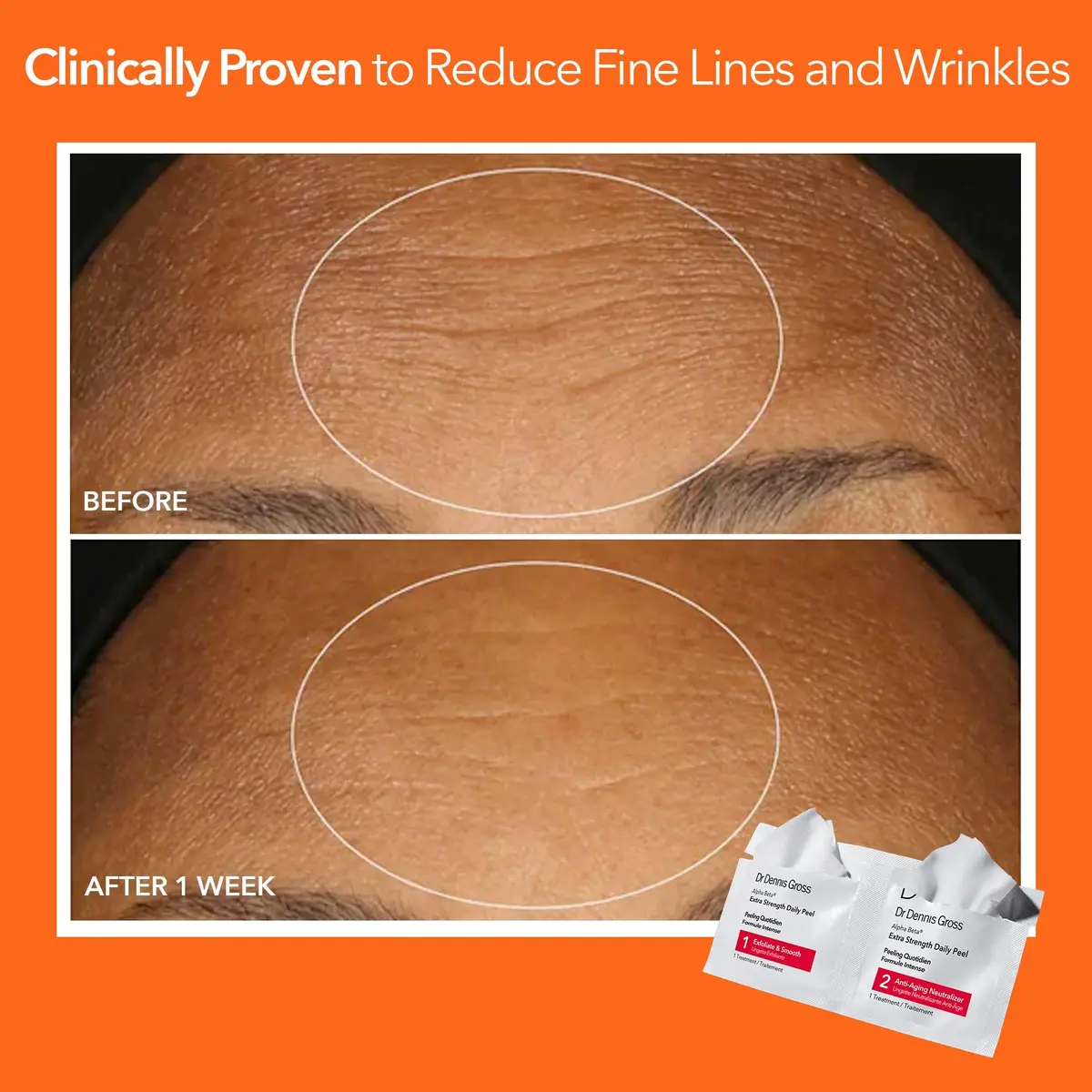 Dr Dennis Gross Alpha Beta Extra Strength Exfoliating Daily Peel 5 Pack | Professional Results for Radiance & Pores - view 6