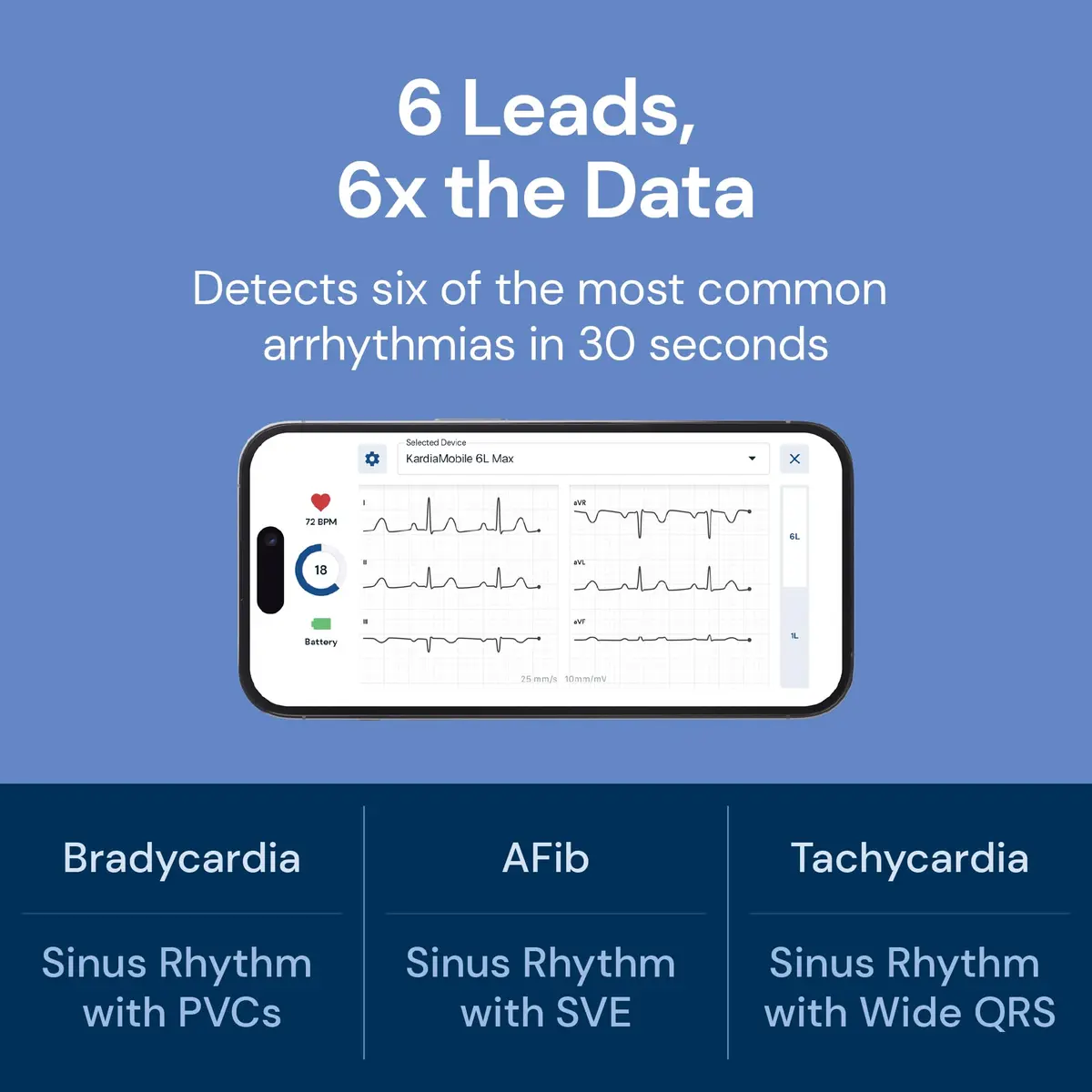 KardiaMobile 6L Max EKG Monitor with 1-Year KardiaCare | FDA-Cleared, Medical-Grade Heart Monitor, 30-Second Results, Unlimited Recordings - view 3