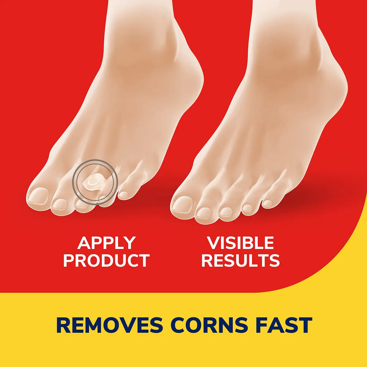 Dr. Scholl's Corn REMOVERS 9 Ct | Fast Corn Removal, Maximum Strength, All Day Stay - view 3