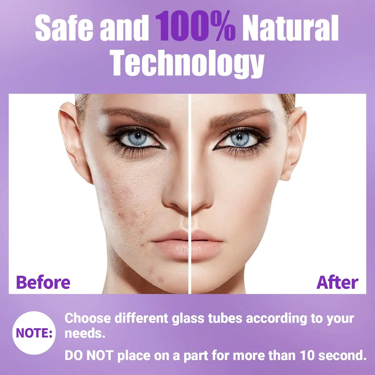 UUPAS High Frequency Facial Wand with 4 Violet Glass Electrodes | Portable Handheld Skin Therapy Device - view 5