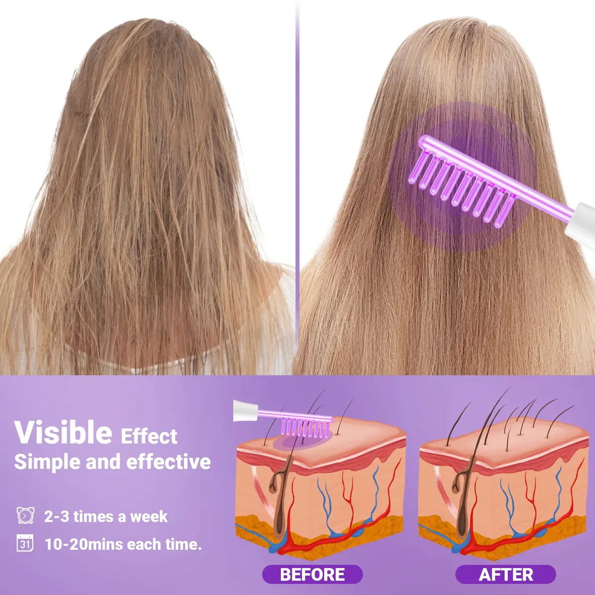 UUPAS High Frequency Facial Wand with 4 Violet Glass Electrodes | Portable Handheld Skin Therapy Device - view 6