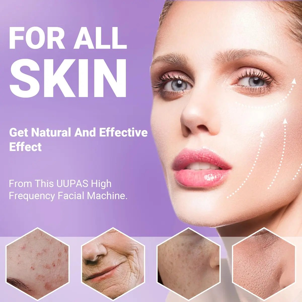 UUPAS High Frequency Facial Wand with 4 Violet Glass Electrodes | Portable Handheld Skin Therapy Device - view 4