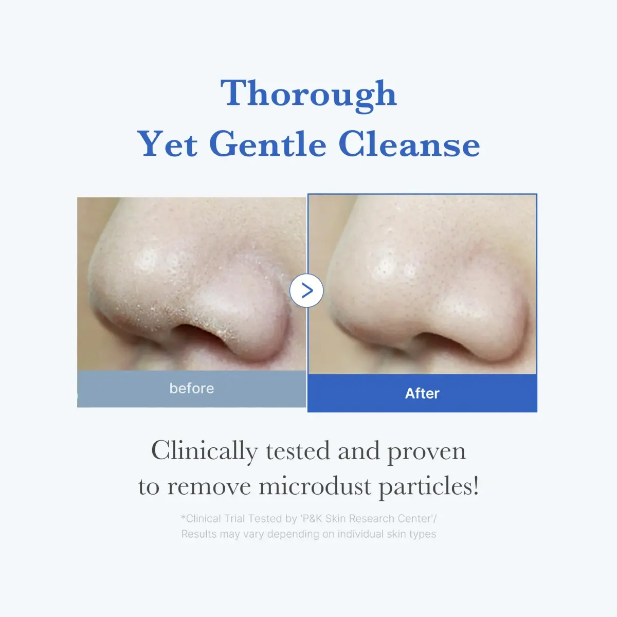 medicube Zero Foam Cleanser 120ml (4.23 Fl Oz) | Gentle Pore & Oil Care for Sensitive Skin - view 3