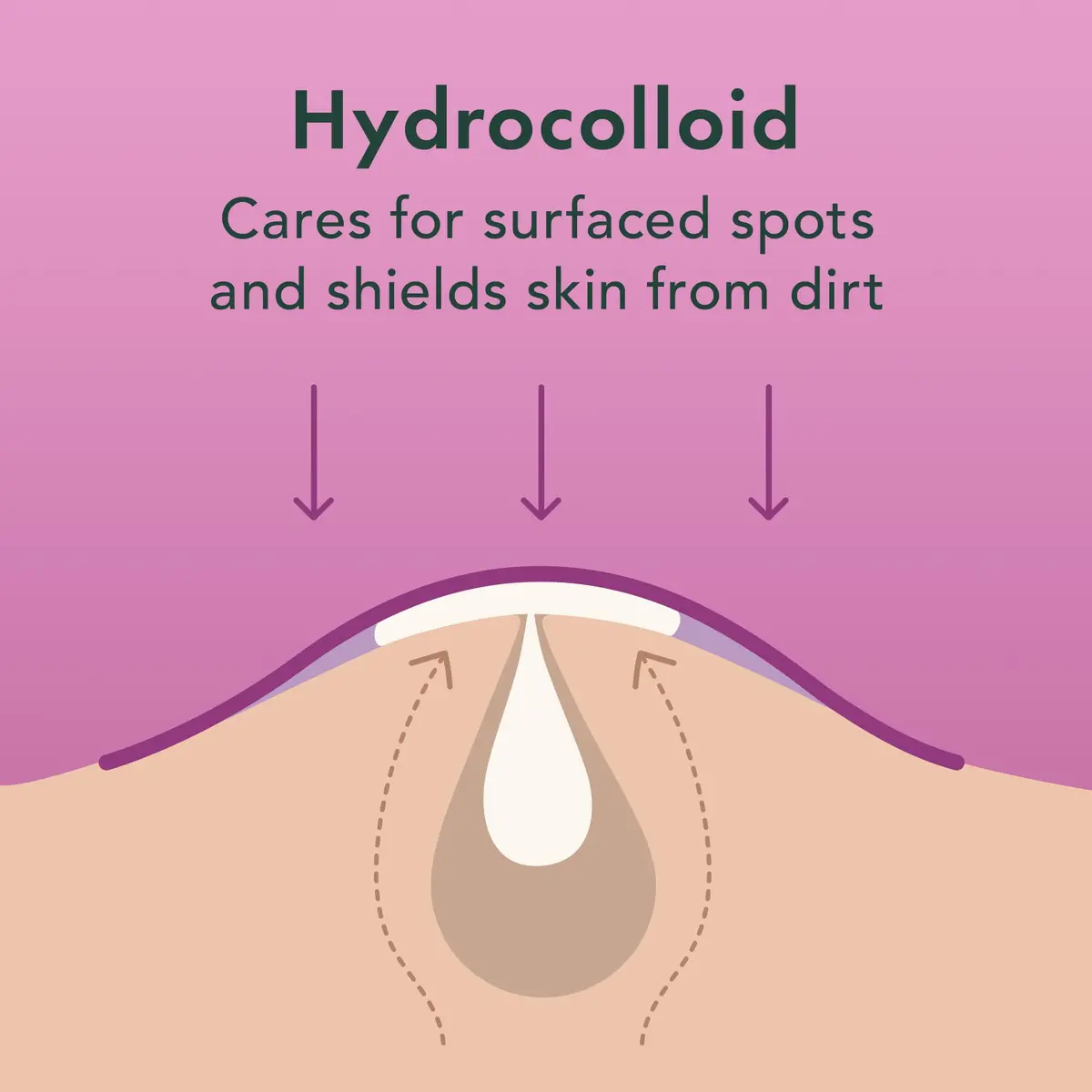 Rael Hydrocolloid Acne Pimple Patches 52 Ct | Overnight Spot Cover for All Skin Types - view 4