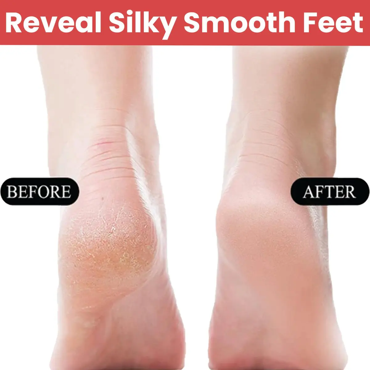 Temperia Professional Metal Foot Scrubber Tool 25.9 cm (10.2 inch) | Removes Dead Skin & Calluses - view 2