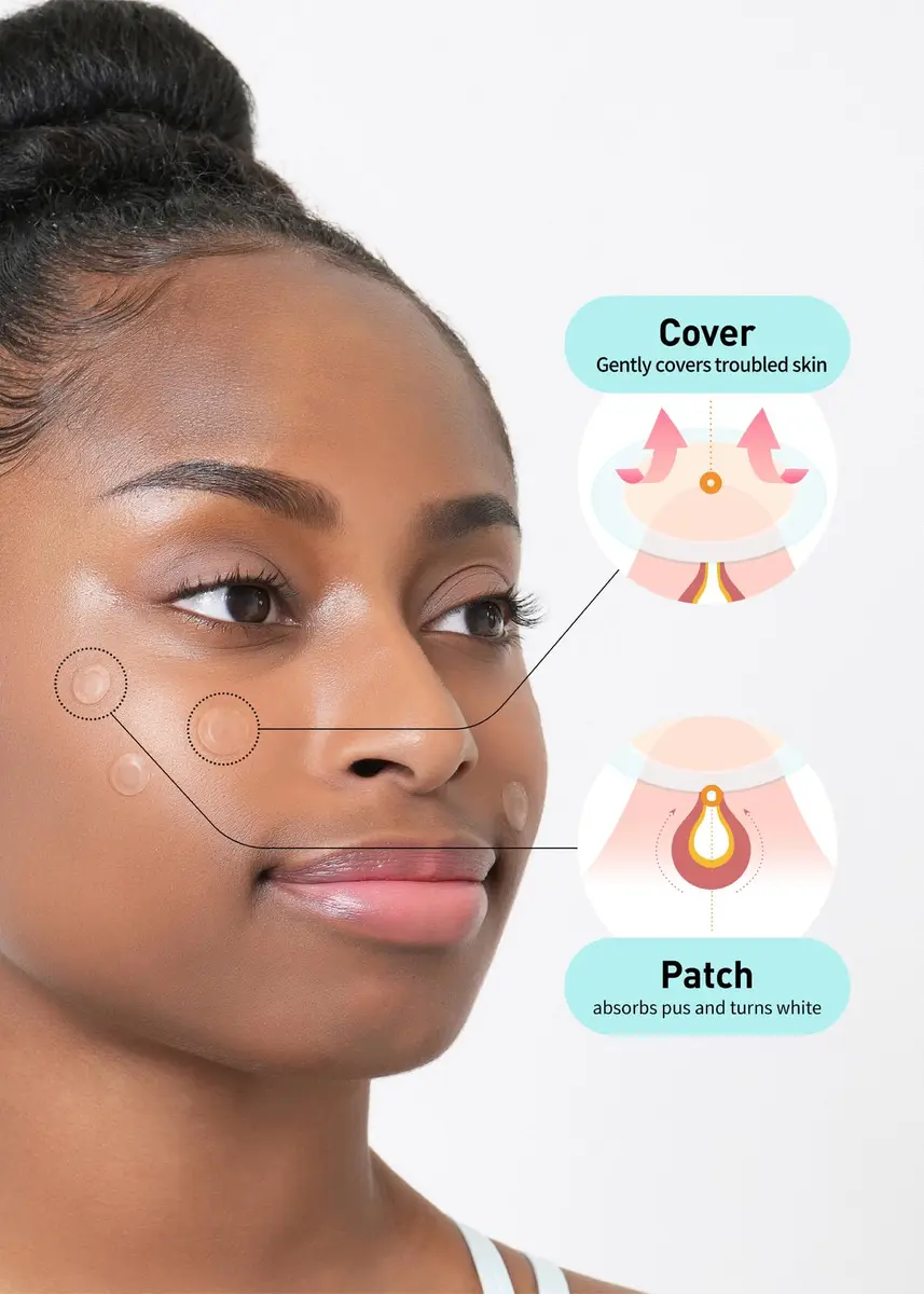 OLIVE YOUNG Hydrocolloid Spot Patch Big 81 Count | Acne & Pimple Treatment for All Skin Types - view 3