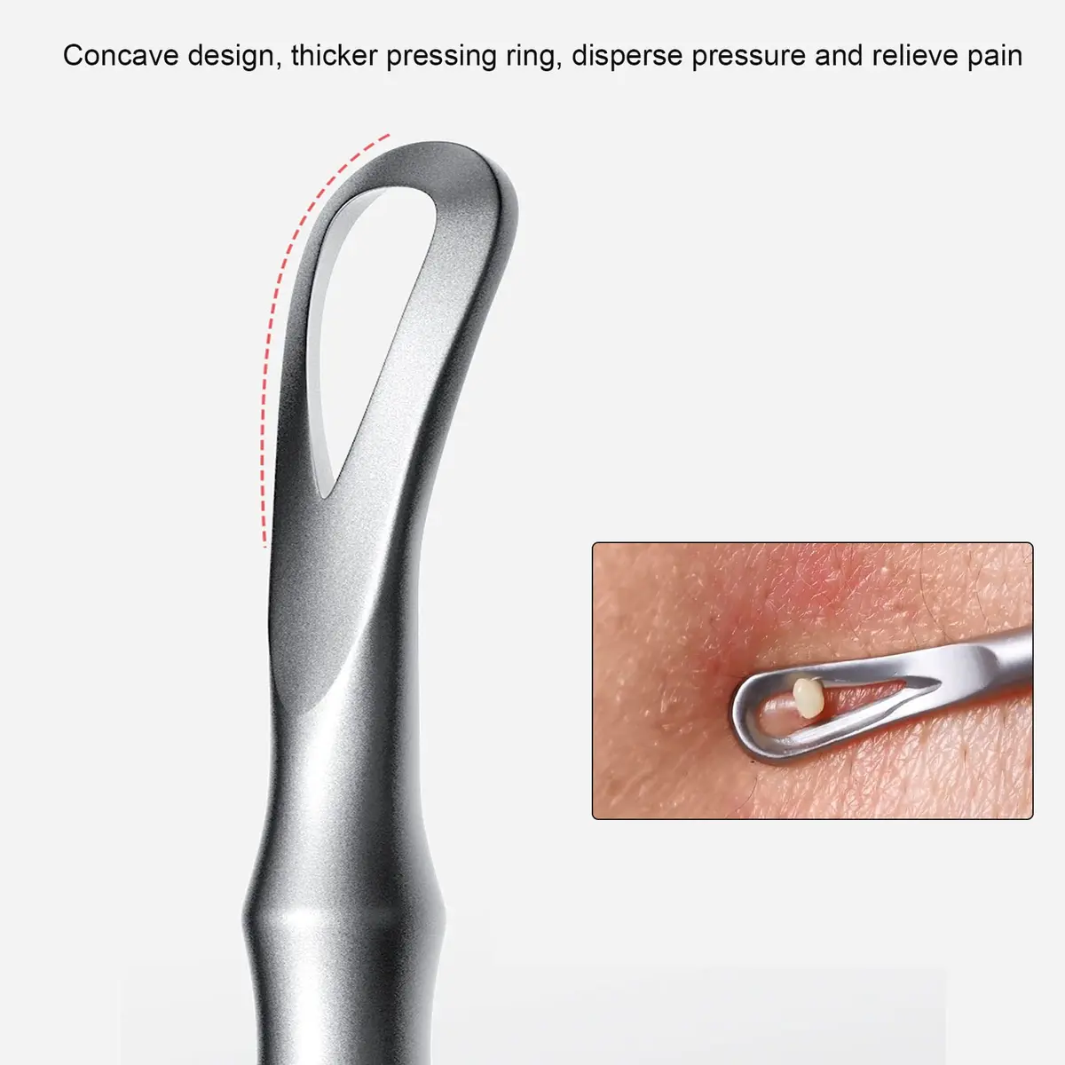 jaxiria Skin Care Tool - Stainless Steel Blemish Remover for Face & Nose | 1 Count - view 2