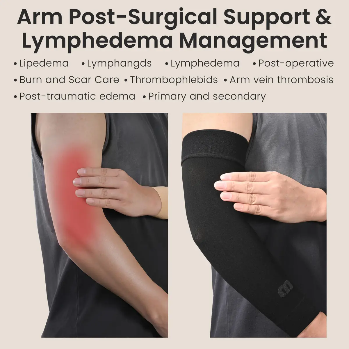 MGANG Medical Compression Arm Sleeve 20-30 mmHg, Lymphedema & Post-Surgery | FDA Approved Graduated Compression - view 6