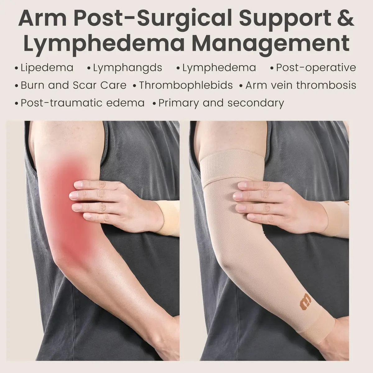 MGANG Medical Compression Arm Sleeve 15-20 mmHg, Lymphedema & Post-Surgery Support | German-Engineered 80% Nylon, 20% Spandex - view 6