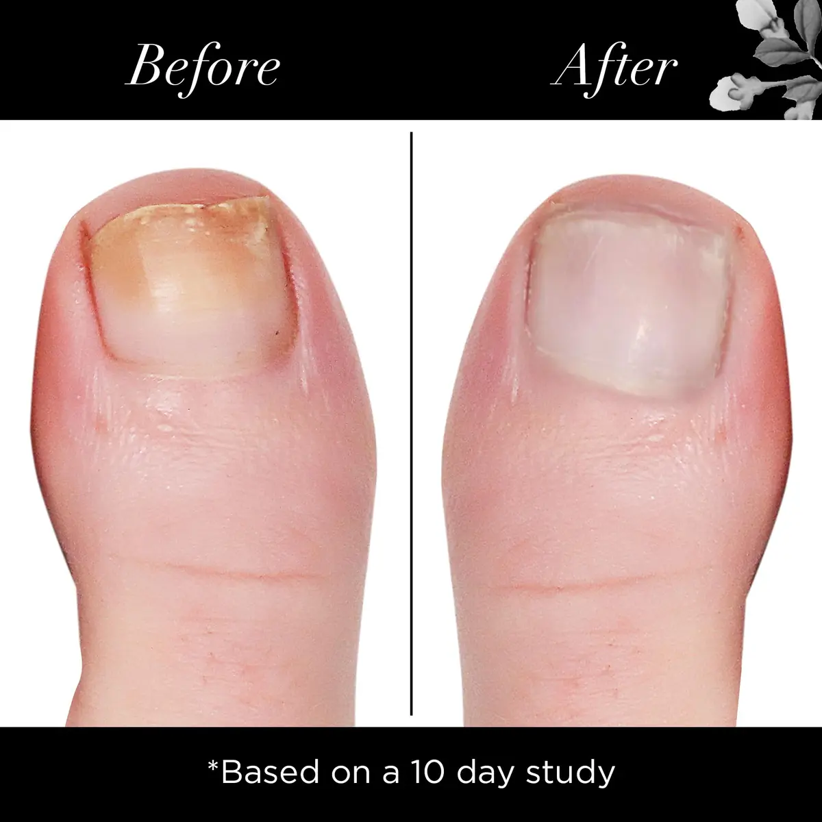 butter LONDON Nail Brightening Concealer 0.4 Fl Oz | Toxin-Free Nail Care & Brightening - view 4