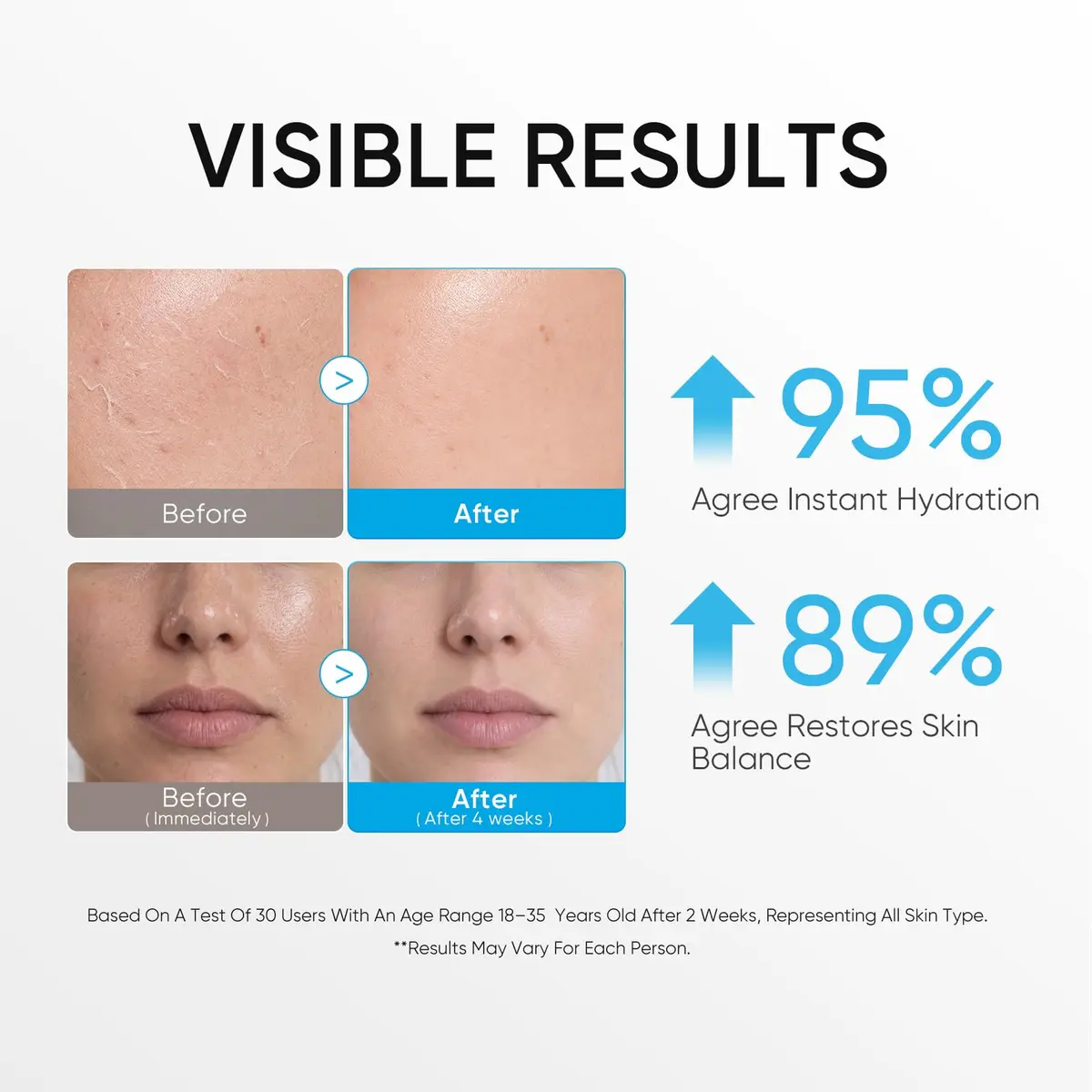 SKINTIFIC 5X Ceramide Barrier Repair Moisturizer for Sensitive Skin | Hydrates & Strengthens Skin Barrier - view 4
