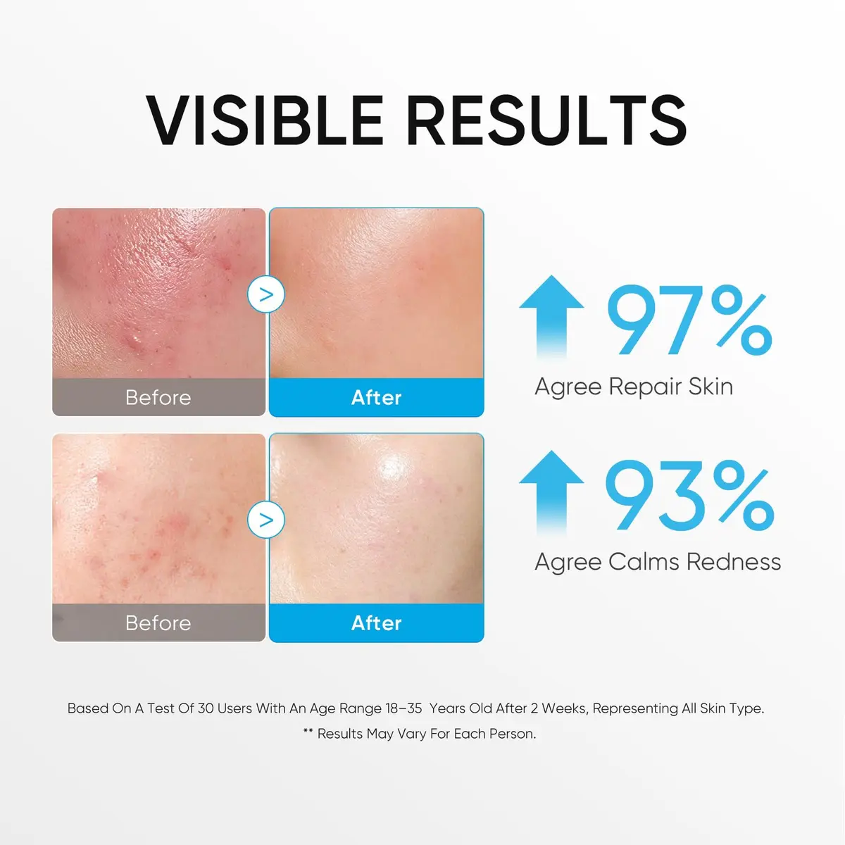 SKINTIFIC 5X Ceramide Barrier Repair Moisturizer for Sensitive Skin | Hydrates & Strengthens Skin Barrier - view 3