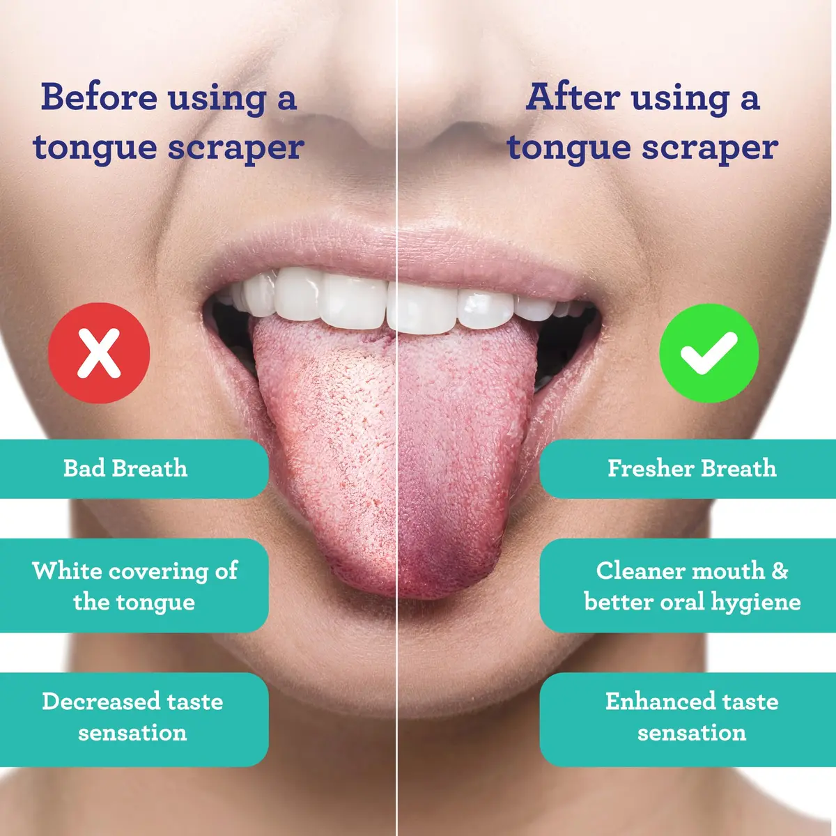 GuruNanda Tongue Scraper for Adults (2 Pack) with Travel Case | Stainless Steel Oral Care Tool - view 2
