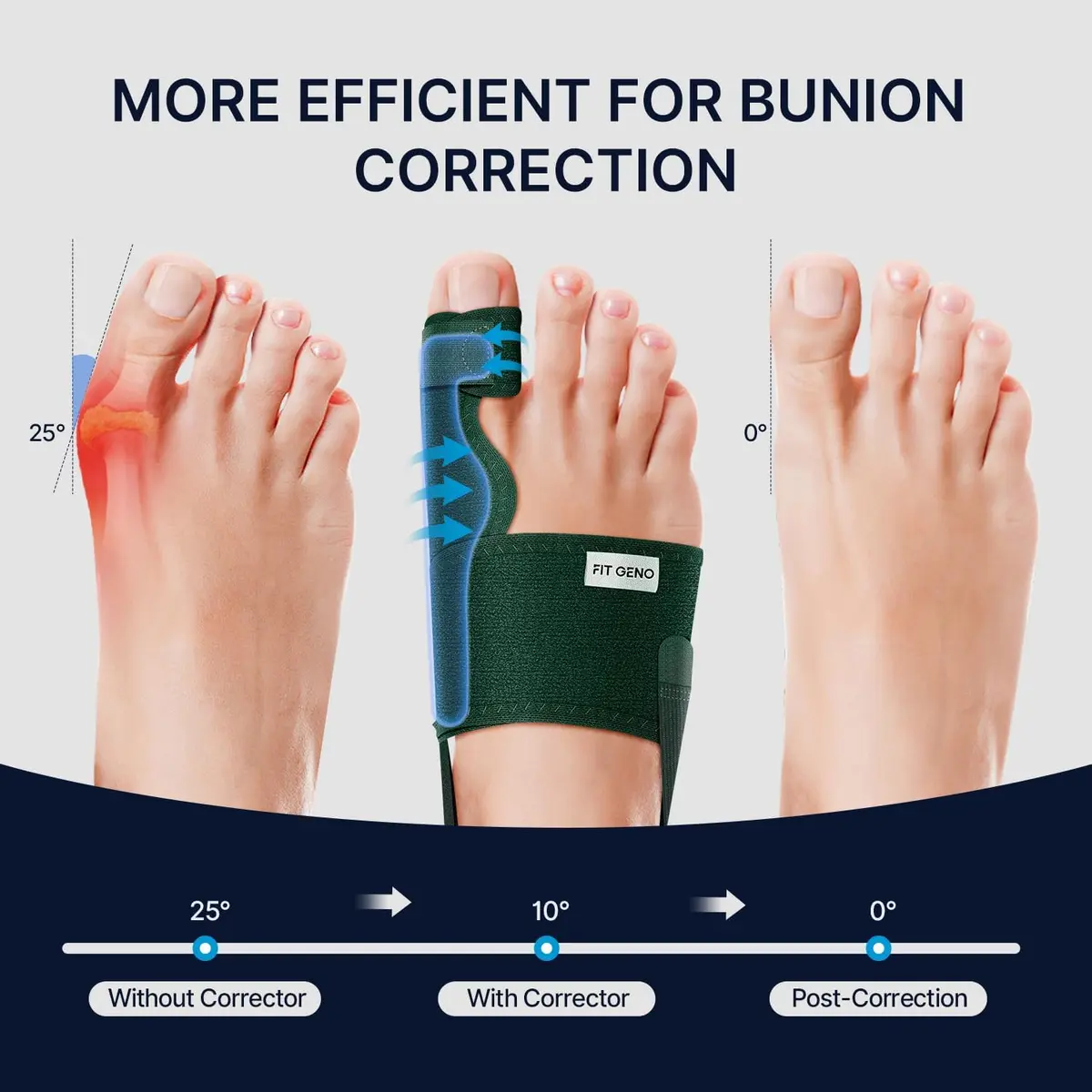 Fit Geno Bunion Corrector Women & Men Big Toe | Adjustable Orthopedic Support for Hallux Valgus - view 2