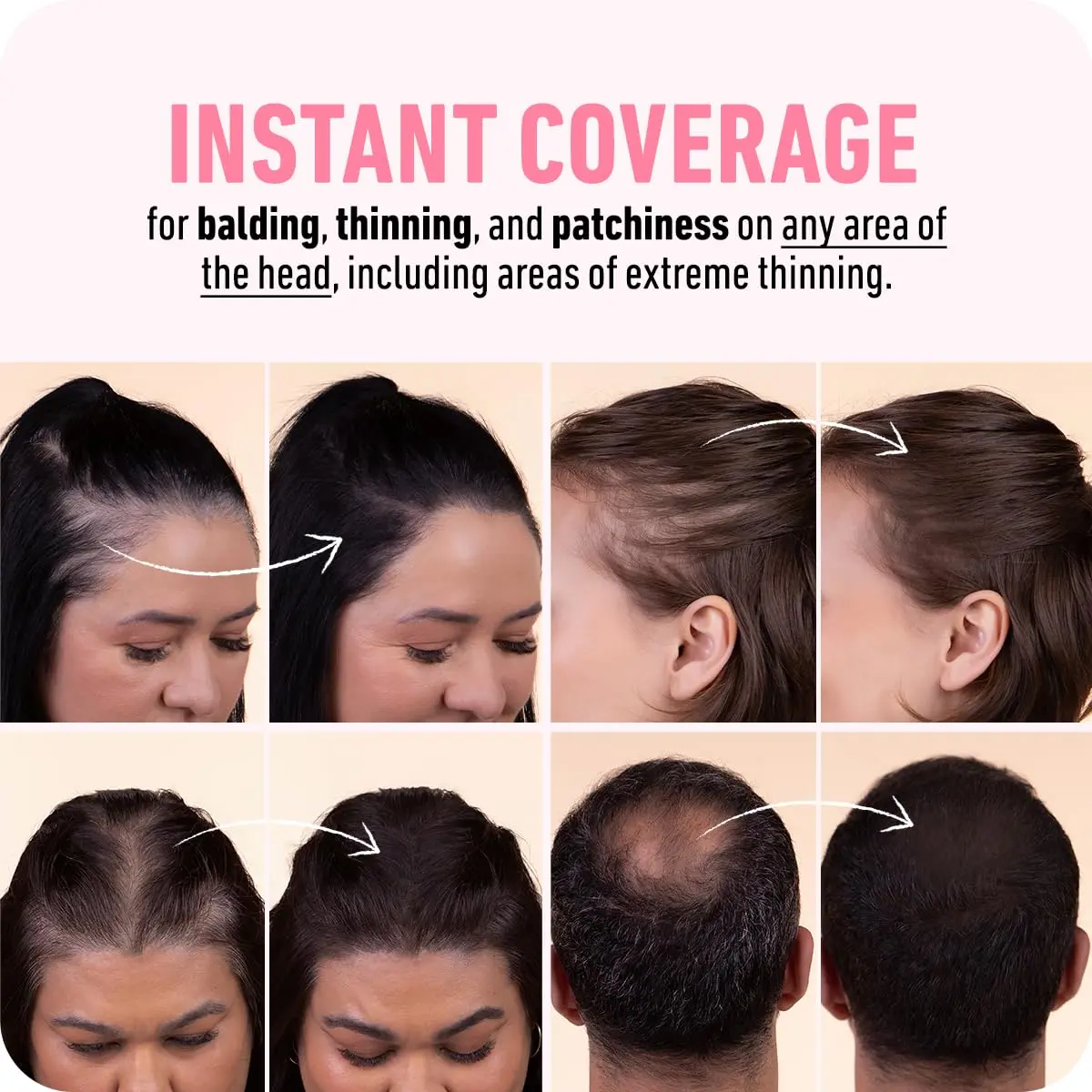 Boldify Hairline Powder Black 10g (0.35 oz) | Instant Root Coverage & Thinning Hair Filler - view 5