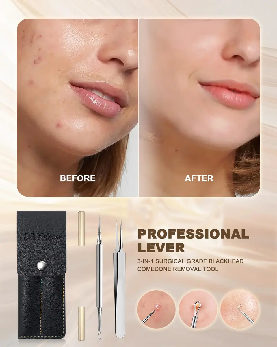 SG Nekoo Professional Milia & Blackhead Removal Tool Kit with Titanium Alloy Needle & Tweezers | Titanium Gold - view 2