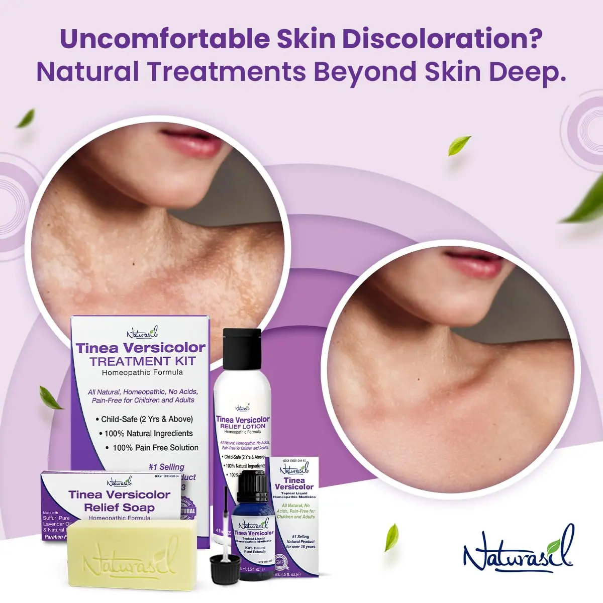 Naturasil Tinea Versicolor Treatment Lotion for Uneven Skin Tone | Fast-Acting Homeopathic 4 oz - view 7