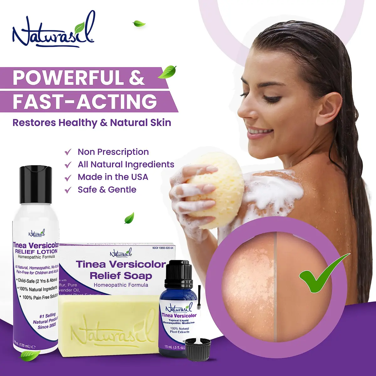 Naturasil Tinea Versicolor Treatment Lotion for Uneven Skin Tone | Fast-Acting Homeopathic 4 oz - view 8