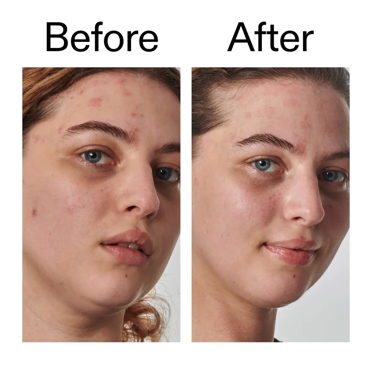 The INKEY List SuperSolutions Urea 10% Moisturizer 50ml | Fast Absorbing, Hydrates & Exfoliates Very Dry Skin - view 7