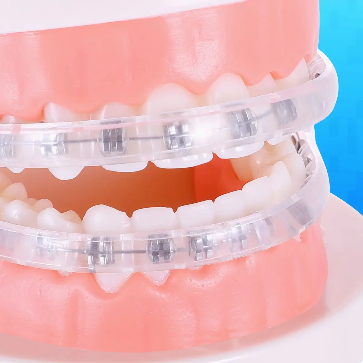 Obrush Comfort Covers for Braces | Orthodontic Mouth Guard & Lip Protector, Clear, 4.2"/3.9" - view 5