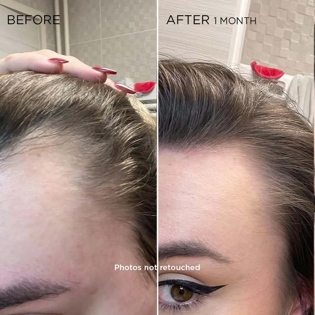 PHYTO Women Revitalizing Hair Serum 12 Vials | Supports Reactional Hair Thinning, Stress & Postpartum Recovery - view 3