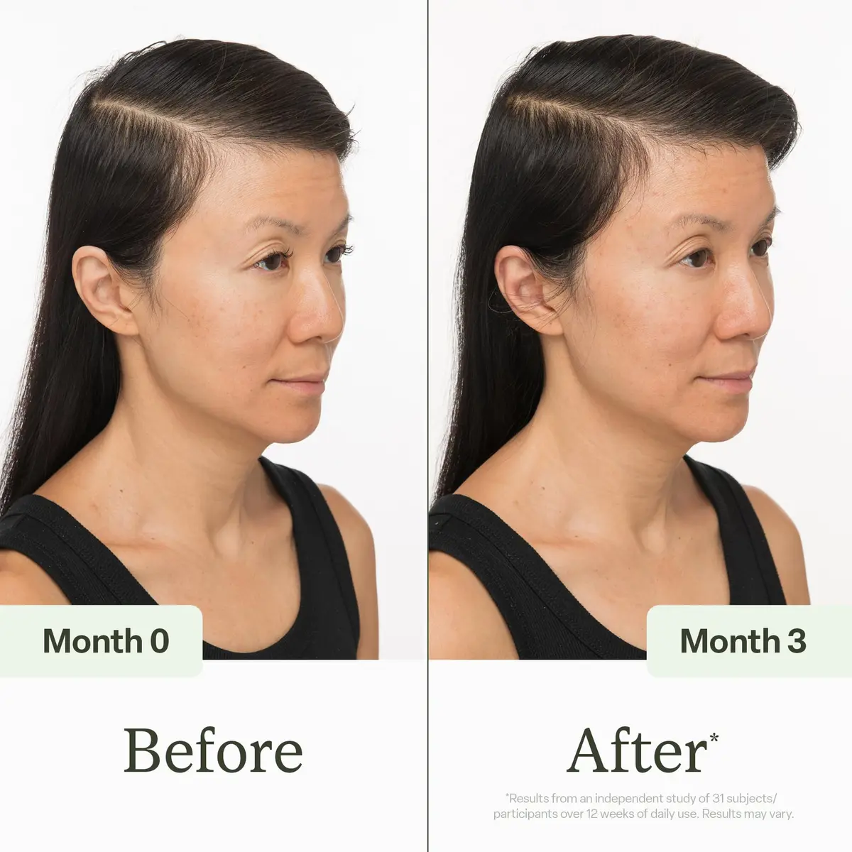divi Scalp Serum | To Promote Fuller-Looking Hair with Peptides | 100 ml - view 3