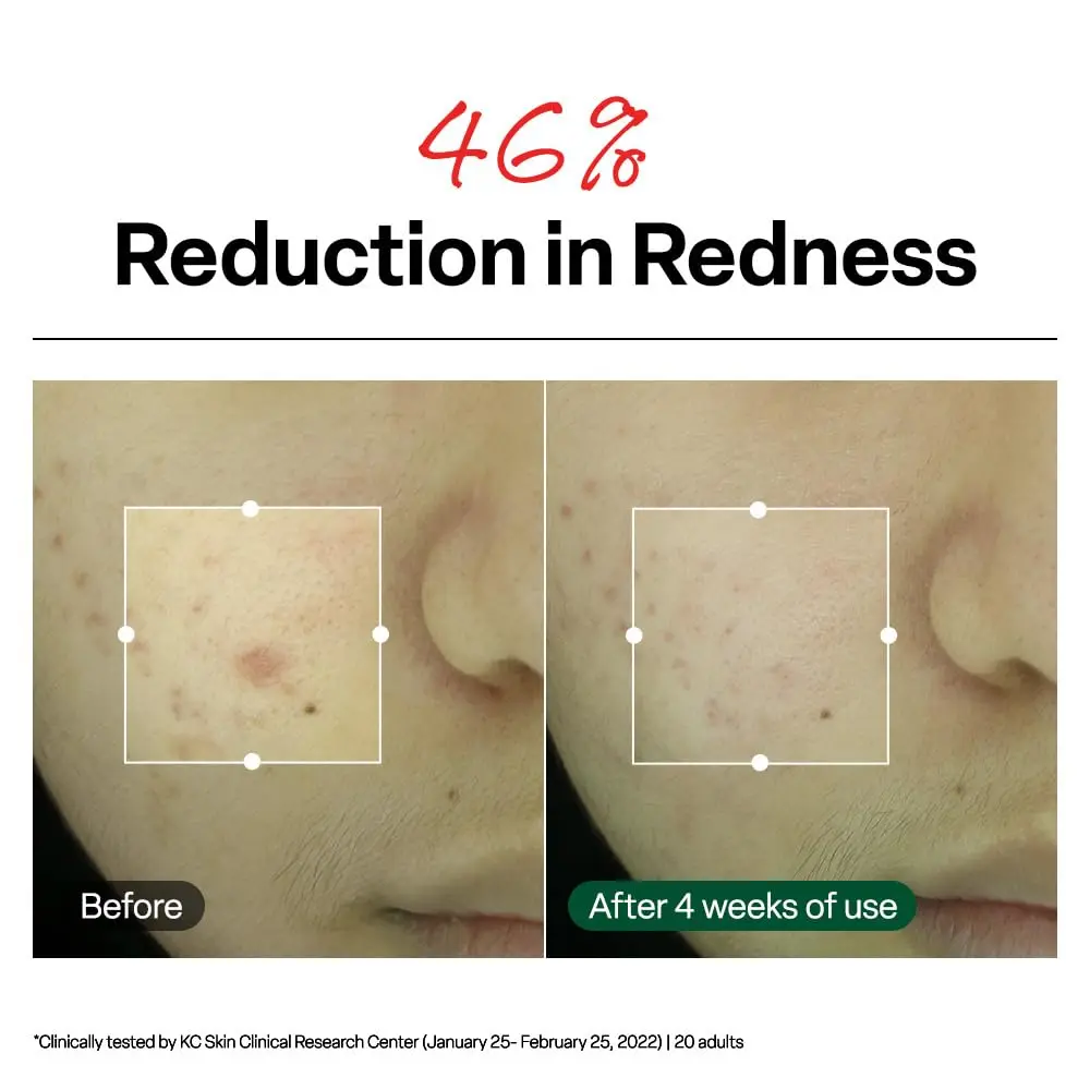Dr.G R.E.D. Blemish Clear Soothing Face Cream 70ml (2.36 fl oz) | Lightweight Hydration for All Skin Types - view 4