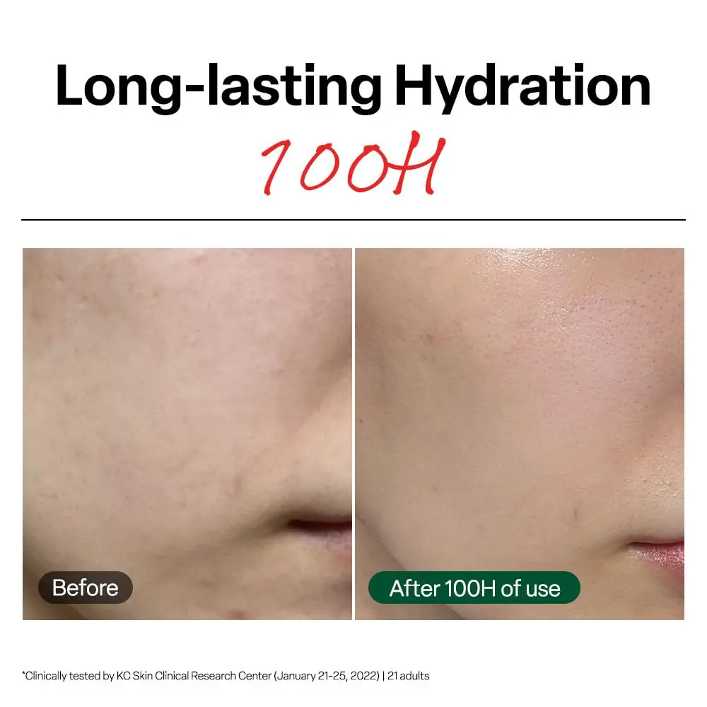 Dr.G R.E.D. Blemish Clear Soothing Face Cream 70ml (2.36 fl oz) | Lightweight Hydration for All Skin Types - view 3