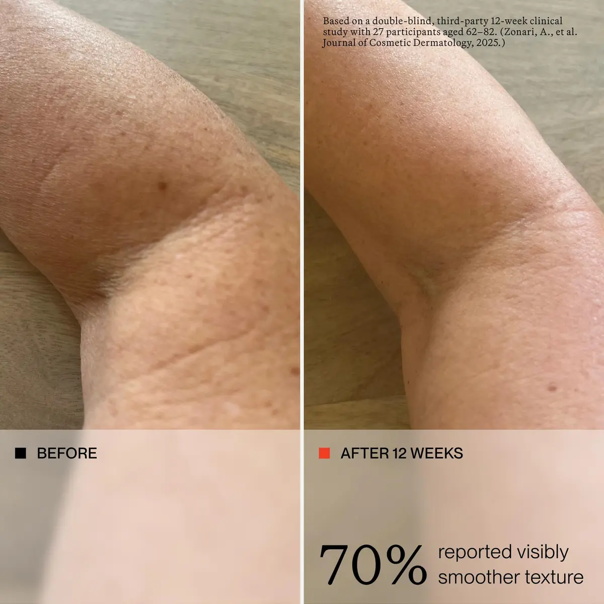 oneskin OS-01 BODY Peptide Moisturizer, 8.45 Fl Oz | Supports Skin Longevity & Hydration - view 4