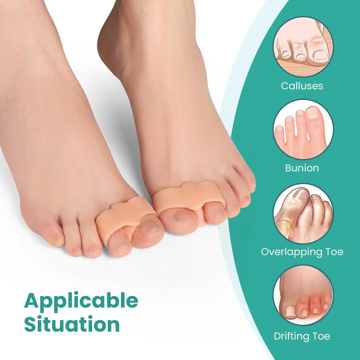 Welnove Bunion Corrector Pack of 12 | Toe Separators for Overlap & Bunions, Soft Gel, Reusable, Suitable for Men & Women - view 3