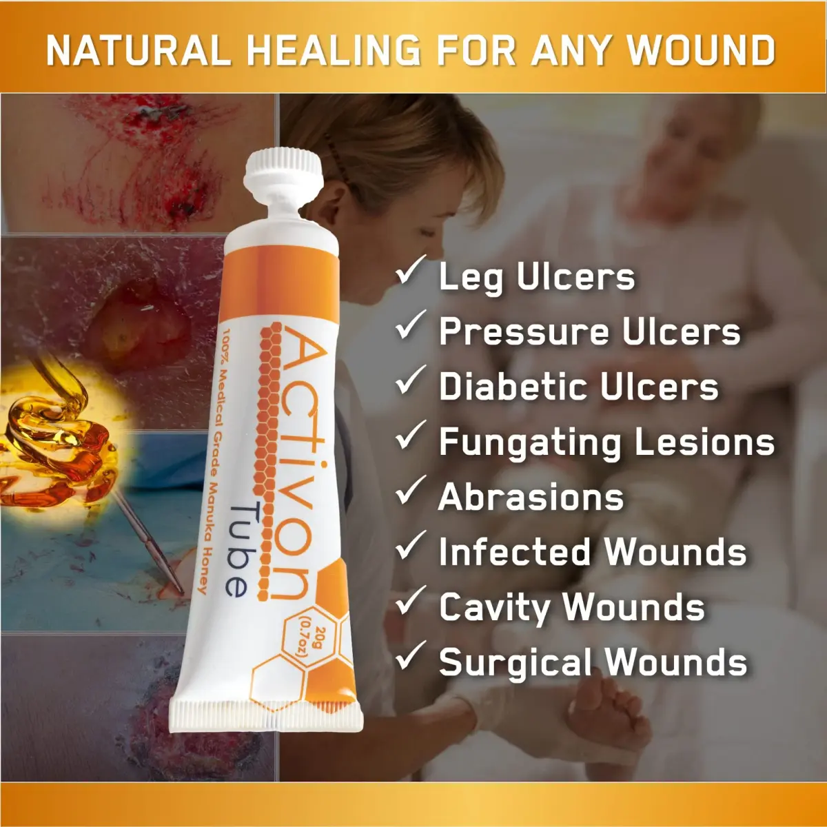 ActivOn Medical Grade Manuka Honey Gel 60g (0.21 oz) | Pack of 3 Tubes for Wound Care - view 3