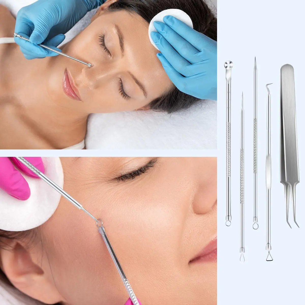 yuntop Blackhead Remover Tool Kit 5 Pack Stainless Steel | Professional Face Nose Extractor (70-120 chars) - view 6