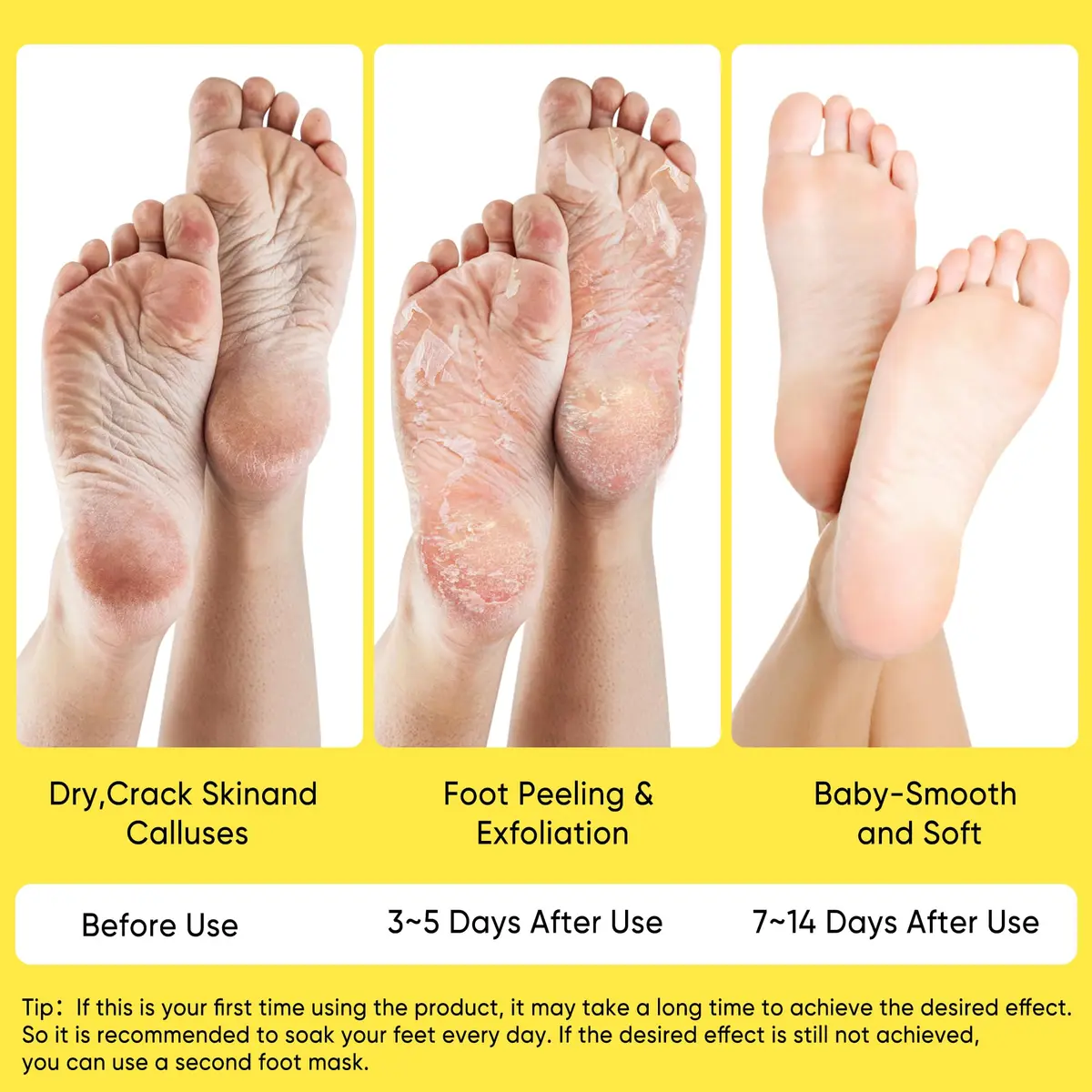 Berlaney Foot Peeling Mask for Dry Cracked Feet 3 Pairs | Exfoliating Peel with Shea Butter (60ml/2.03 Fl Oz) | Unisex - view 4