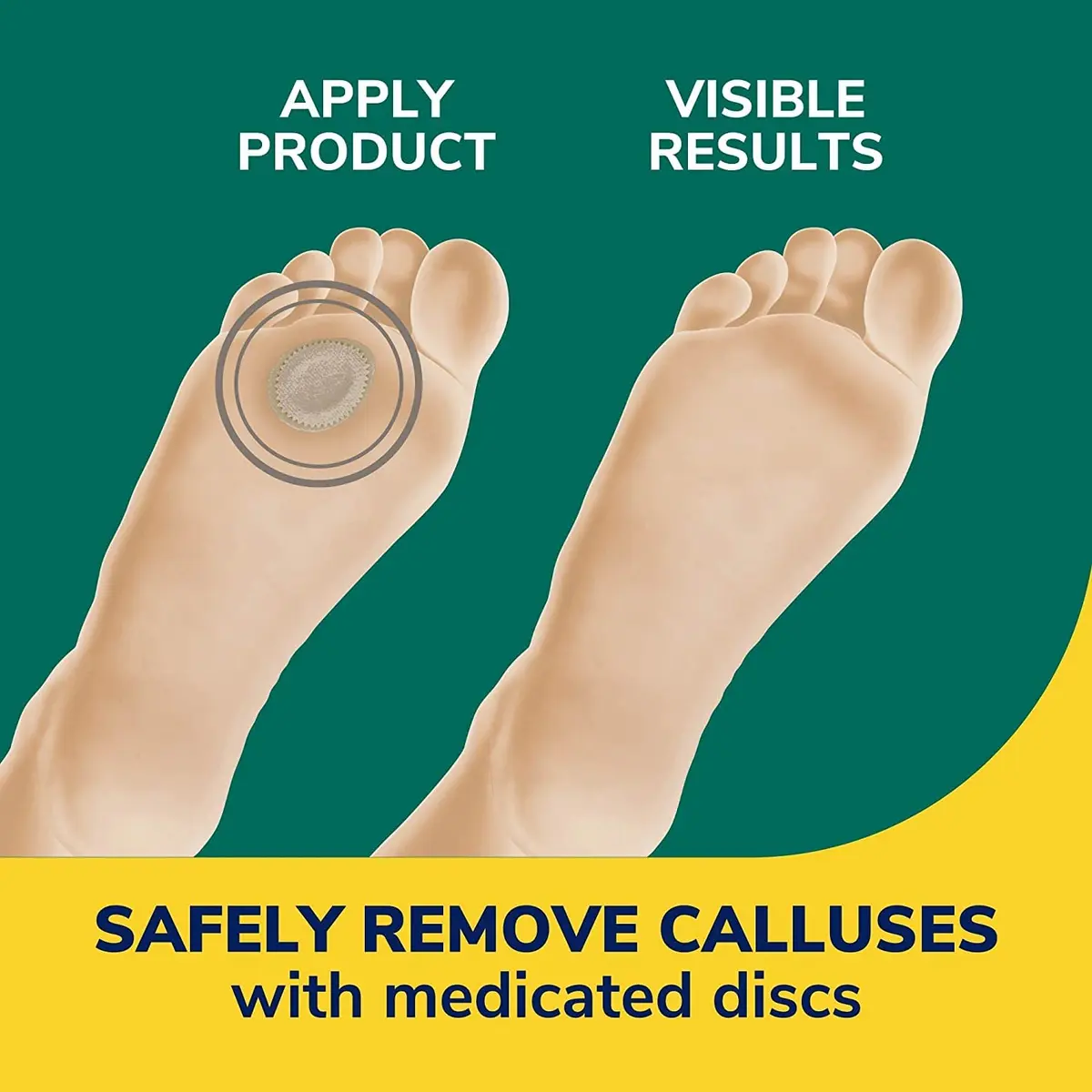 Dr. Scholl's Extra Thick Callus Remover Pads 4ct (Pack of 2) | Medicated Discs for Pain Relief - view 3
