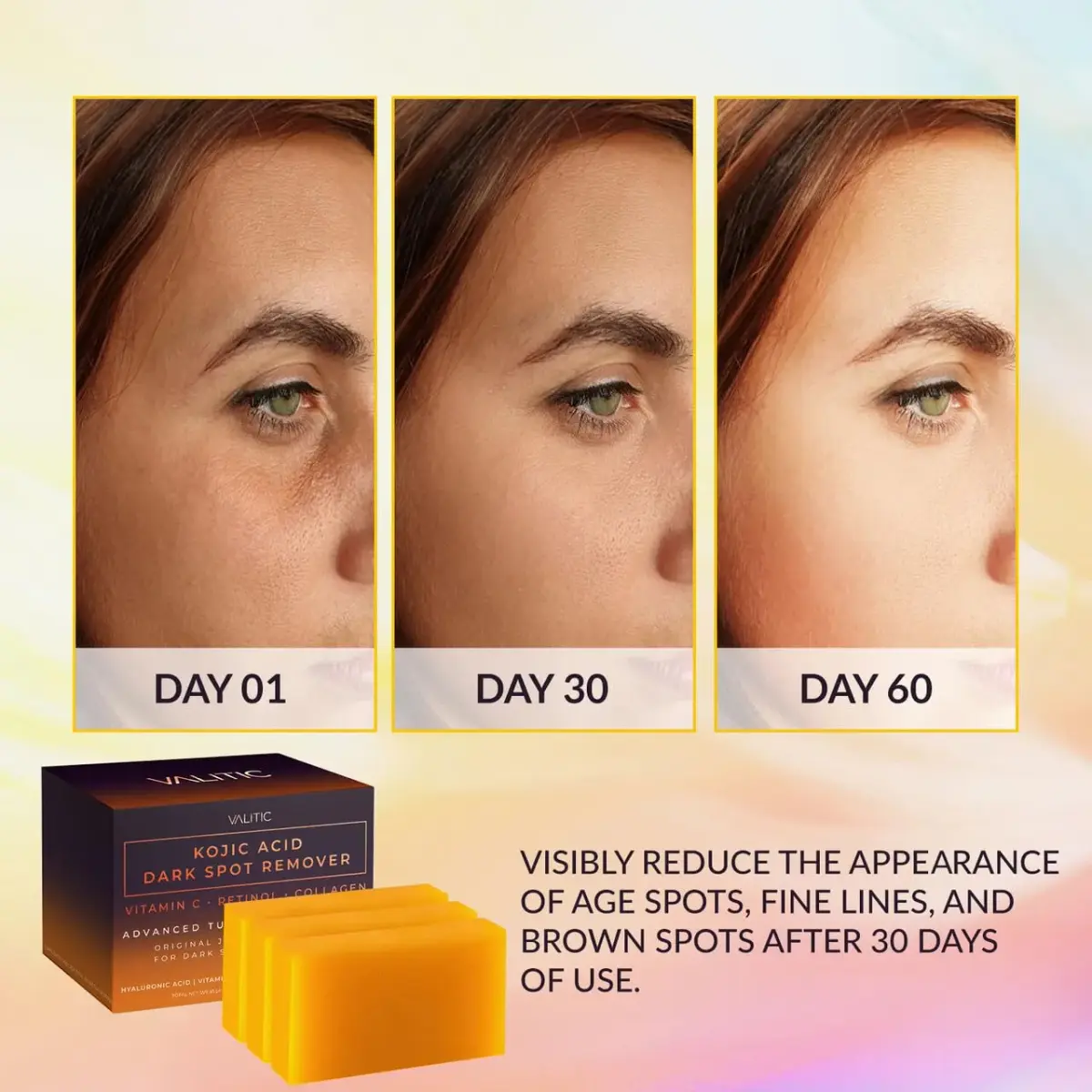 VALITIC Kojic Acid Dark Spot Corrector Soap Bars with Vitamin C, Retinol, Collagen, Turmeric - Original Japanese Complex - Hyaluronic Acid, Vitamin E, Shea Butter, Castile Olive Oil - 3 Pack With Bag | 300g (10.5 oz) | For Face & Body - view 2