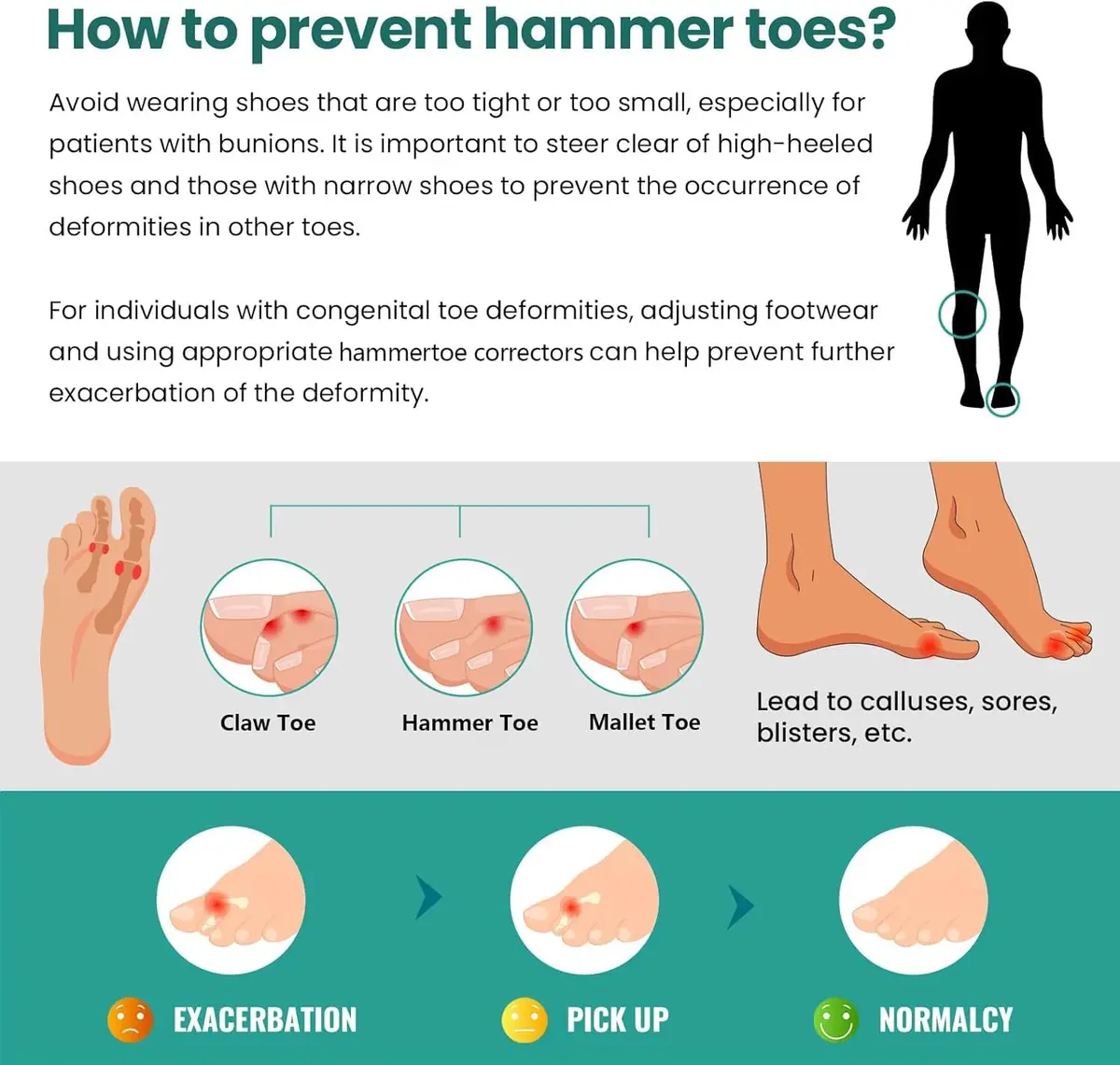 Welnove Hammertoe Corrector 6 Pack Toe Splints - Soft Gel Toe Straighteners for Bent, Curled, Crooked, Claw, Hammer Toes - 3 Different Sizes (Green) - view 4