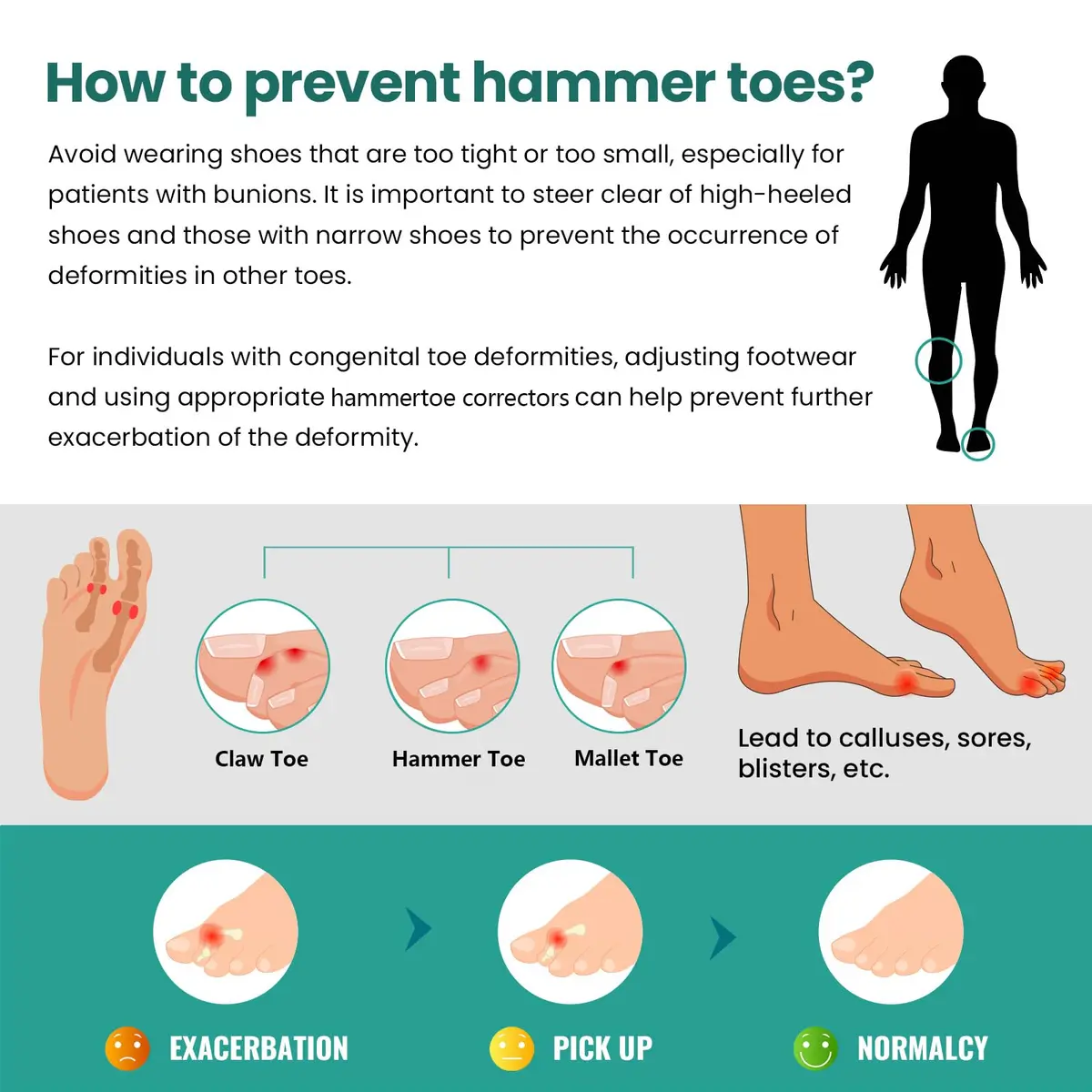 Welnove Hammertoe Corrector - 6 Pack Toe Splints - Soft Gel Toe Straighteners - Realign Bent, Curled, Crooked, Claw, Hammer Toes - Corrector for Men and Women, Large (Beige), FSA or HSA Eligible - view 7