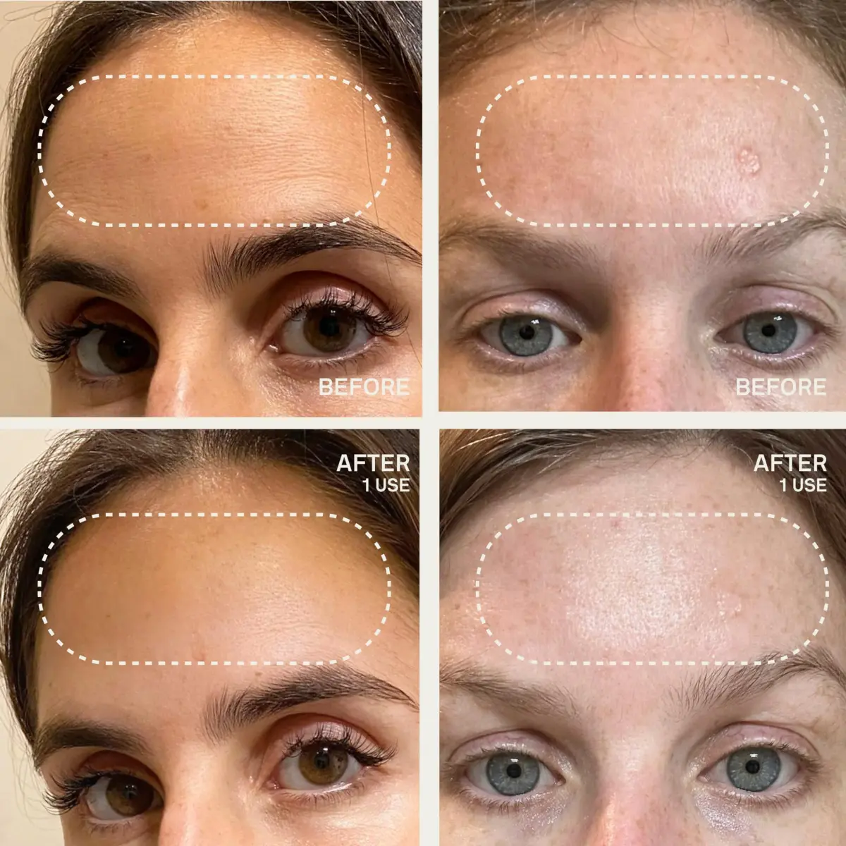 Dermaclara Forehead Patch - Reusable Silicone Wrinkle Patches for Face Overnight | 1 Count - view 5