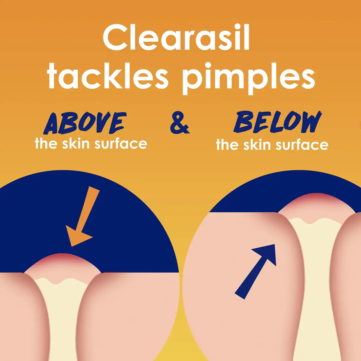 Clearasil Stubborn Acne Control 5in1 Daily Facial Cleansing Pads with Salicylic Acid 180 Count (Pack of 2) | Fights Pimple Size, Oil, and Marks - view 3