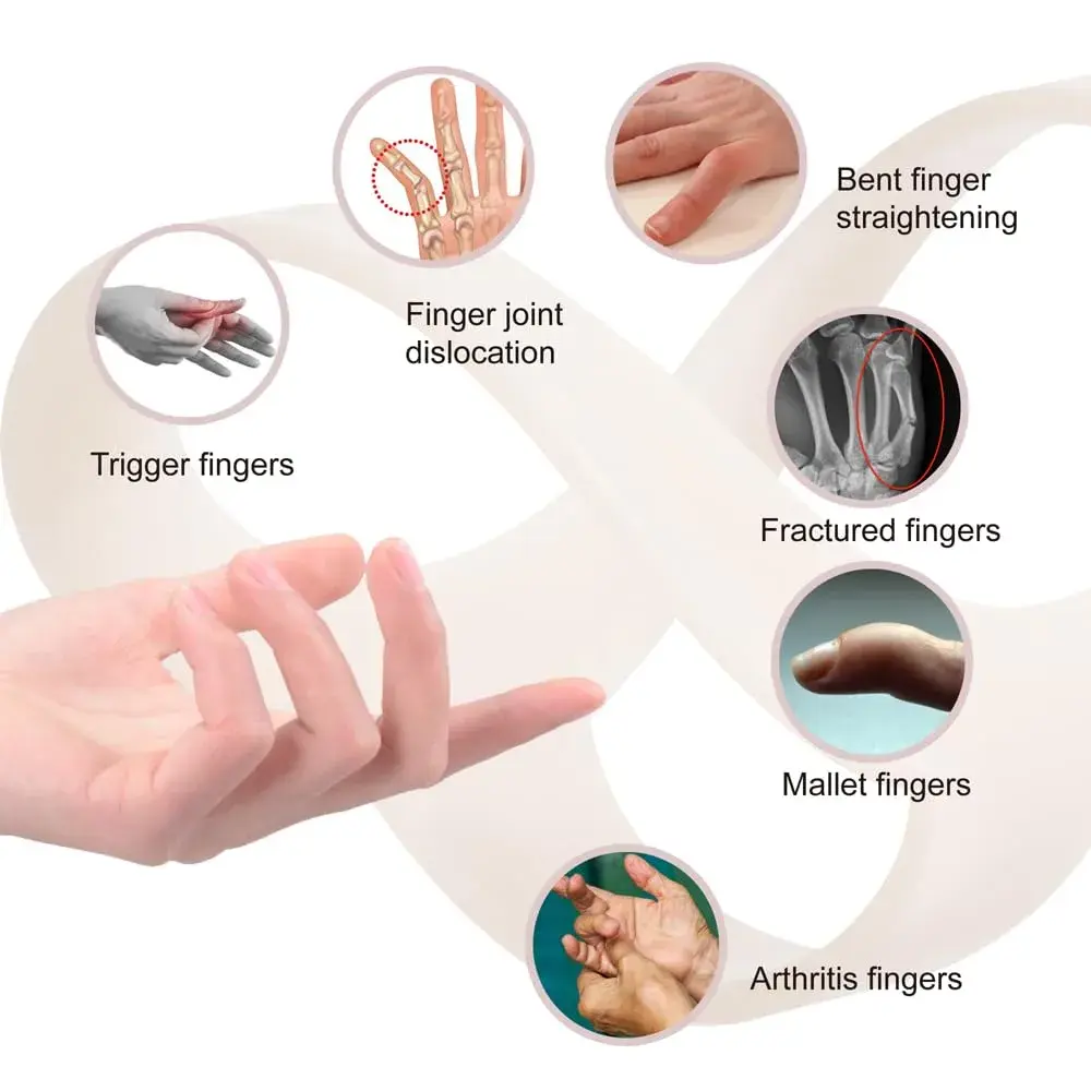 UAKIKAU Oval Finger Splint 8 pcs, Medium (1.5-2.7 Inches) | Supports Mallet, Trigger, Arthritis Fingers - view 7